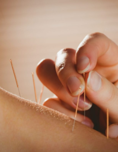 how acupuncture supports fertility