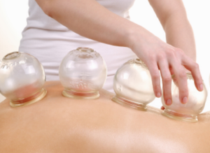 Cupping and Gua Sha: Exploring Ancient Healing Techniques