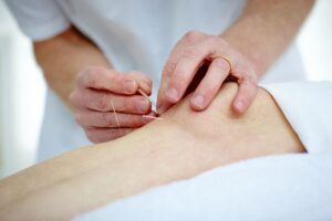  Acupuncture Treat Arthritis Pain