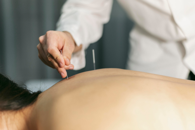 Acupuncture Relieve Chronic Pain