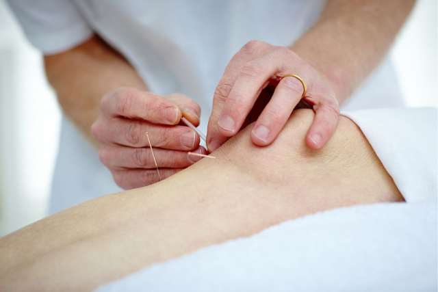 Acupuncture Treat Arthritis Pain