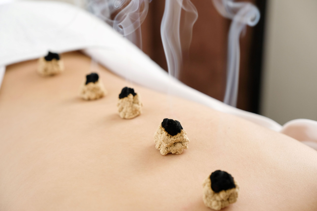 Moxibustion